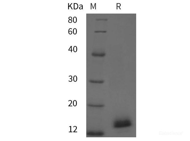 chiken IL2/IL-2/Interleukin-2 Recombinant Protein (His tag)