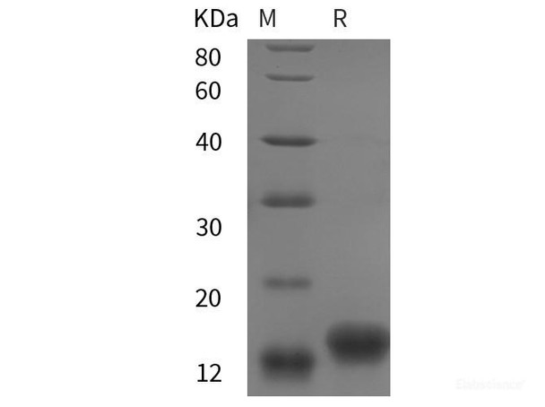 chiken IGF1/IGF‑I/IGF-1 Recombinant Protein (His tag)