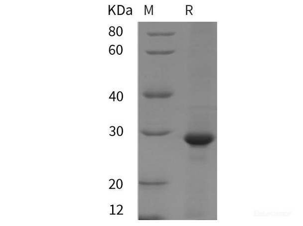 Rat Clusterin/ApoJ Recombinant Protein (His tag)