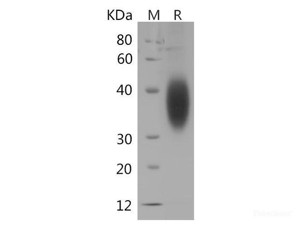 Human B7-H5/Gi24/VSIR Recombinant Protein (His Tag)