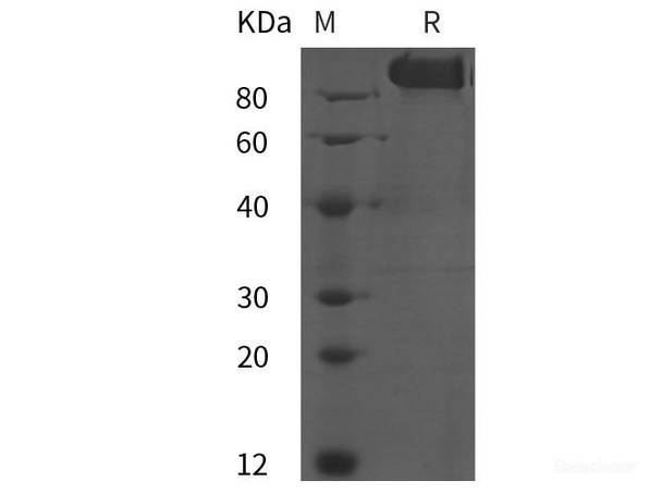 Human VEGFR-2/KDR Recombinant Protein (His tag)