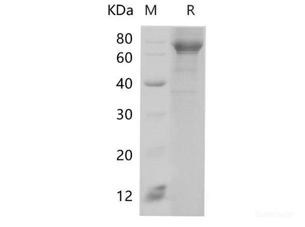 Human HSPA1A Recombinant Protein (His Tag)