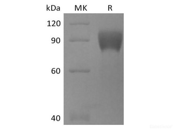 Recombinant Human TPBG/5T4 (C-mFc)