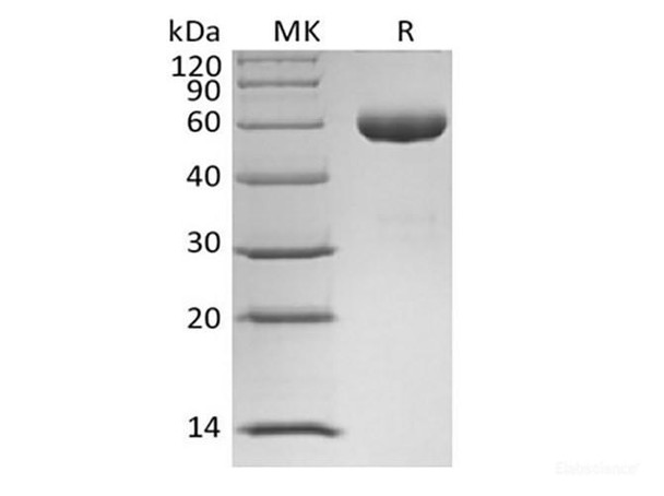 Recombinant Human Angiopoietin-1/ANG1 (N-Fc)