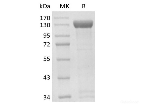 Human Receptor Tyrosine-Recombinant Protein Kinase ErbB-2/HER2 (C-Fc-Avi)  Biotinylated
