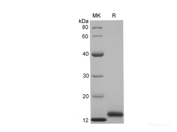 Human CD59 glycoRecombinant Protein Recombinant Protein (His Tag)