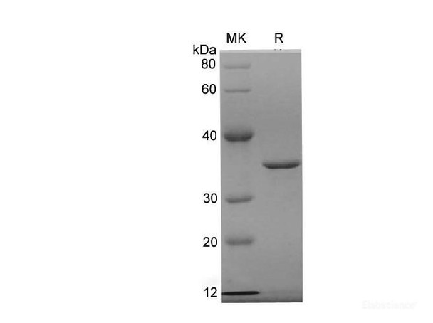 Human CDK4 Recombinant Protein (His Tag)