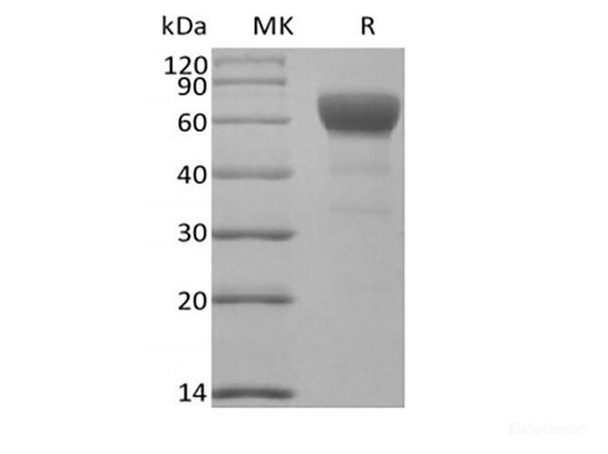 Recombinant Mouse Transforming Growth Factor-Beta Receptor Type II/TGFBR2 (C-Fc)