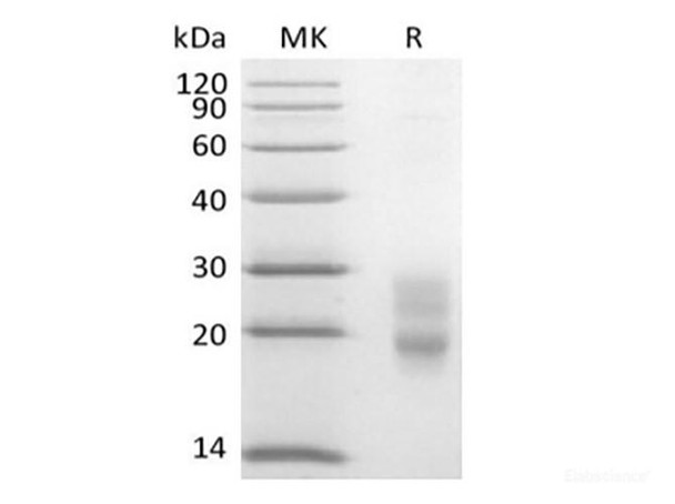 Recombinant Mouse CD7/Leu-9 (C-6His)