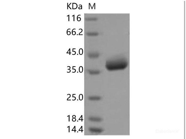 2019-nCoV Spike Recombinant Protein, Biotinylated  (RBD, Avi-His Tag) (Active)