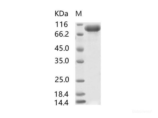 SARS-CoV S1 Recombinant Protein, Biotinylated (His Tag)