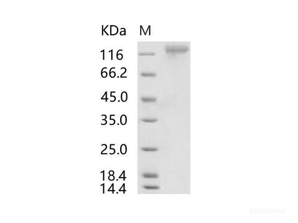 HCoV-HKU1 (Isolate N1) S1 Recombinant Protein (His Tag)