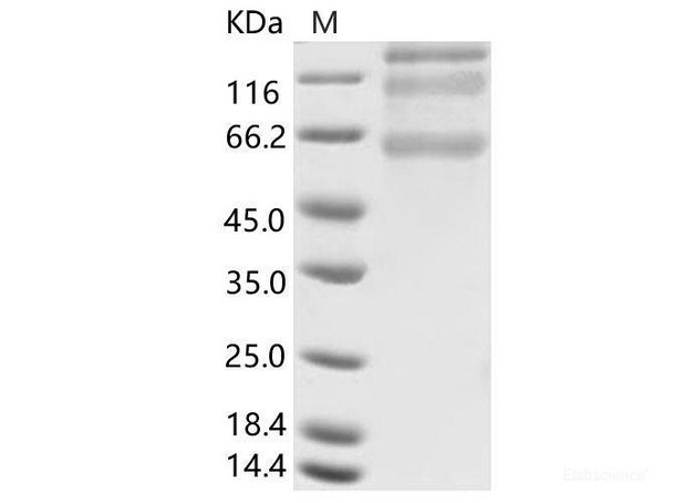 HCoV-HKU1 (Isolate N5) S1+S2 Recombinant Protein (ECD, His Tag)