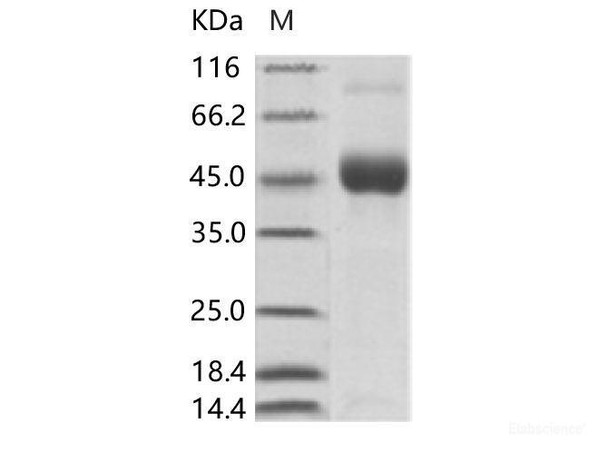 DENV (type 1, strain US/Hawaii/1944) DENV-NS1 Recombinant Protein (His Tag)