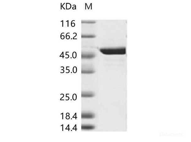 DENV (type 2, strain New Guinea C/PUO-218 hybrid) E / Envelope Recombinant Protein (His Tag)