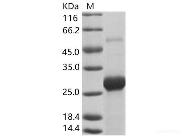 EBOV (subtype Bundibugyo, strain Uganda 2007) VP24 Recombinant Protein (His Tag)