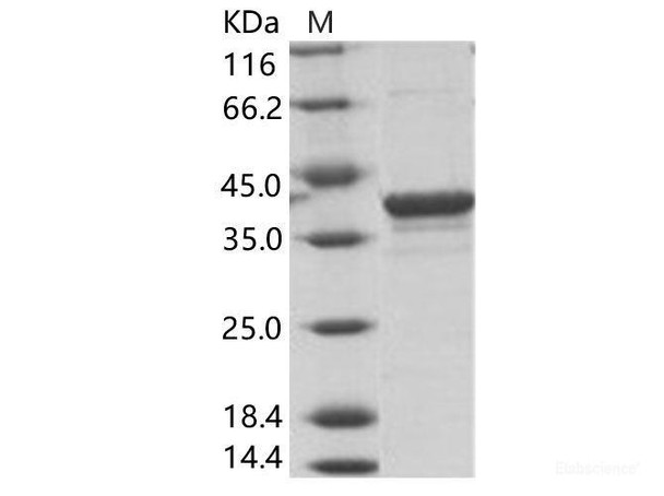 EBOV (subtype Bundibugyo, strain Uganda 2007) VP40 / Matrix Recombinant Protein VP40 Recombinant Protein (His Tag)