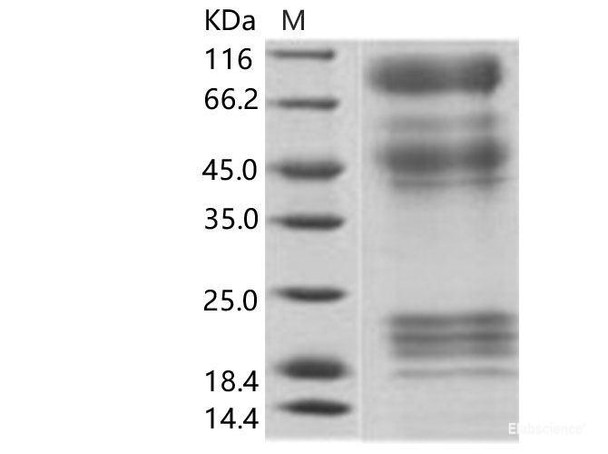 EBOV (subtype Zaire, strain H.sapiens-wt/GIN/2014/Kissidougou-C15) GlycoRecombinant Protein / GP Recombinant Protein (His Tag)