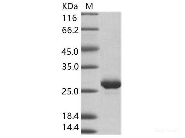 EBOV (subtype Zaire, strain H.sapiens-wt/GIN/2014/Kissidougou-C15) VP24 Recombinant Protein (His Tag)