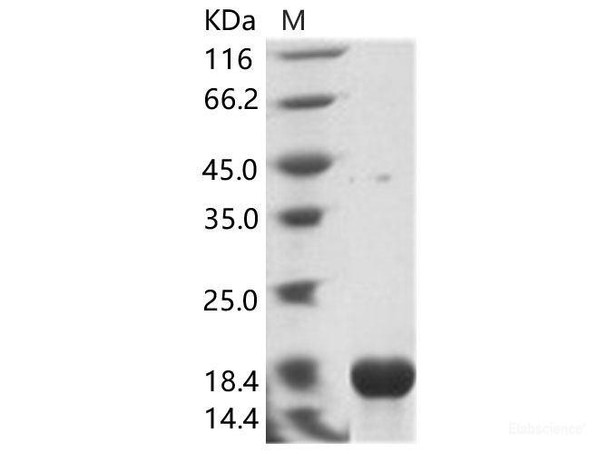 EBOV (Sudan ebolavirus, strain Gulu) NucleoRecombinant Protein / NP Recombinant Protein (His Tag)