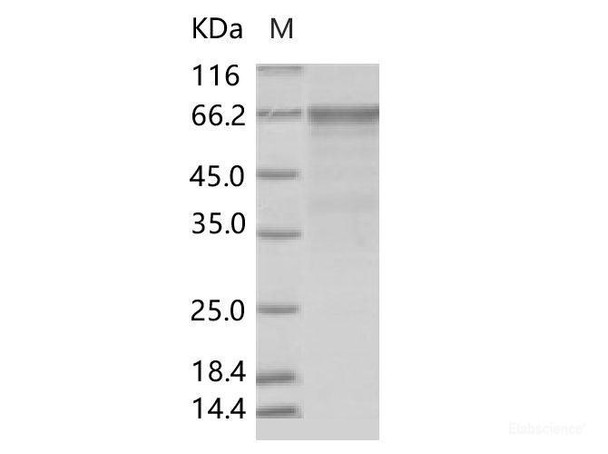 Enterovirus D68 (EV-D68) (strain Fermon) VP1 Recombinant Protein (Fc Tag)