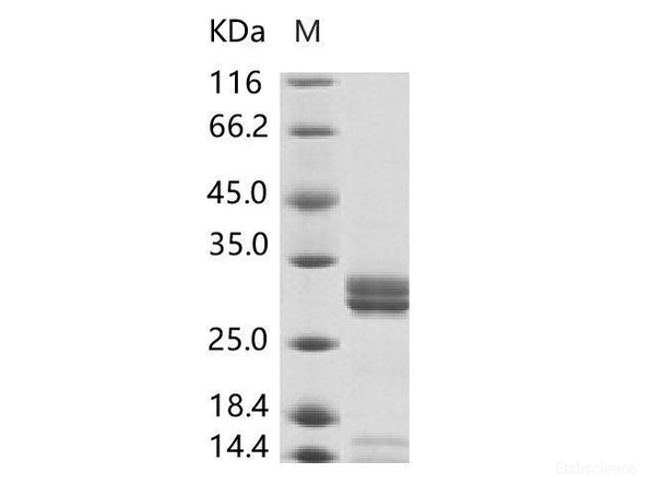 Enterovirus D68 (EV-D68) (strain Fermon) VP4 Recombinant Protein (Fc Tag)