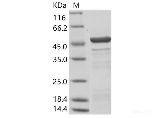 Hantaan virus HTNV (strain 84FLi) Nucleocapsid / NP Recombinant Protein (His Tag)