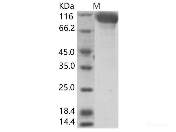 Hendra virus (HeV) (isolate Horse/Autralia/Hendra/1994) GlycoRecombinant Protein Recombinant Protein (Fc Tag)
