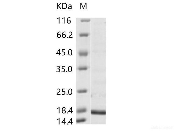 Hepatitis B Virus (HBV) (ayw/France/Tiollais/1979) Capsid Recombinant Protein (His Tag)