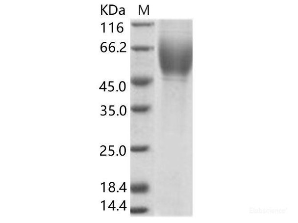 HCV (serotype 1c,isolate HC-G9) E2 Recombinant Protein (His Tag)