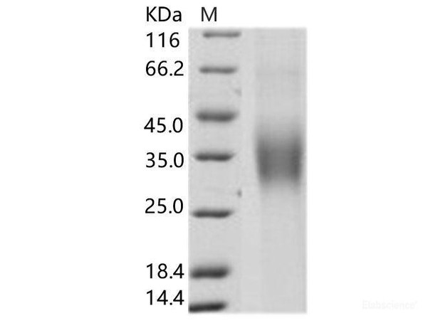 HCV Envelope GlycoRecombinant Protein E1 / HCV-E1 (subtype 1b, strain HC-J4) Recombinant Protein (His Tag)