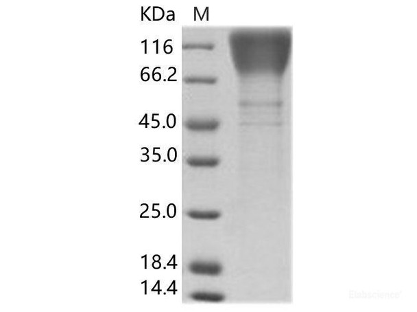 HIV-1 (group M, subtype A, isolate 92RW020) Envelope glycoRecombinant Protein gp160 Recombinant Protein (gp120 subunit) (His Tag)