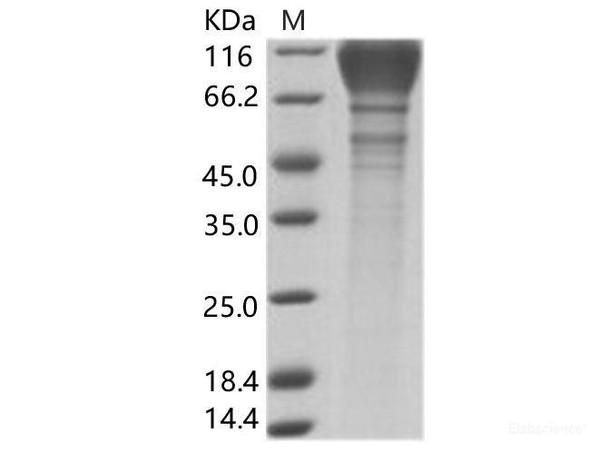 HIV-1 (group M, subtype B, strain SHIV-89.6P) gp120 Recombinant Protein (His Tag)