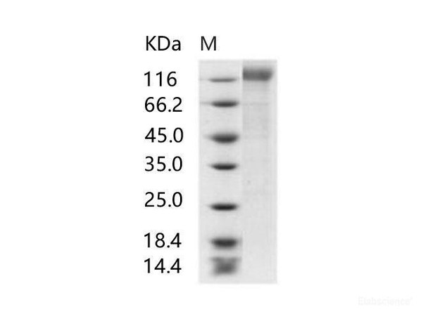 HIV-1 gp140 Recombinant Protein (group M, subtype CRF07_BC) (His Tag)