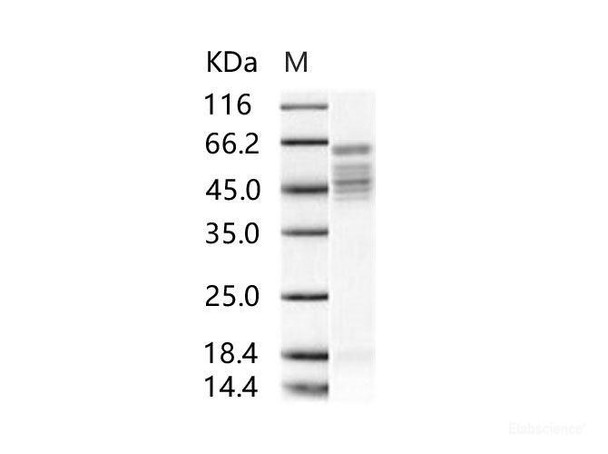 RSV Fusion Recombinant Protein / RSV-F (Strain RSS-2) Recombinant Protein (His Tag)