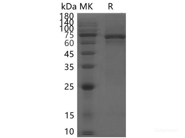 SARS-CoV-2 NSP13 Recombinant Protein