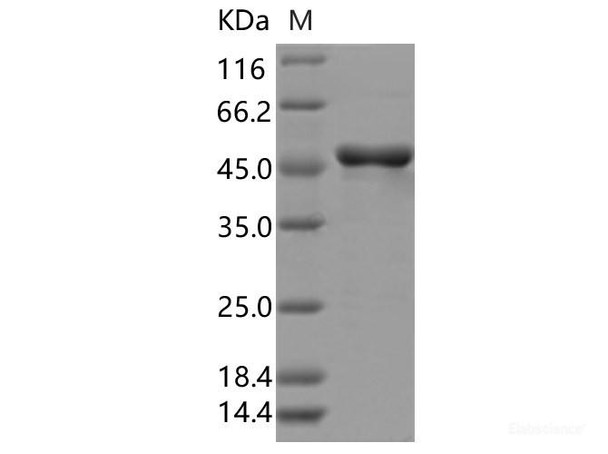 SARS-CoV-2 N Recombinant Protein (D377Y) (His Tag)