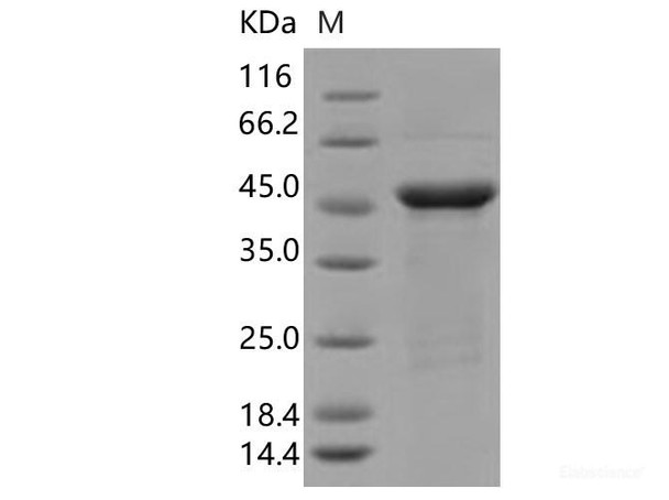 SARS-CoV-2 N Recombinant Protein (R203K, G204R) (His Tag)