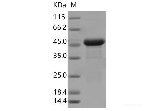 SARS-CoV-2 N Recombinant Protein (I292T) (His Tag)