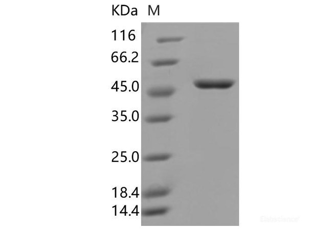 SARS-CoV-2 N Recombinant Protein (D3L,R203K,G204R,S235F) (His Tag)
