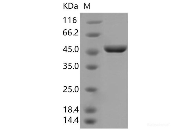 SARS-CoV-2 N Recombinant Protein (D3L,S235F) (His Tag)