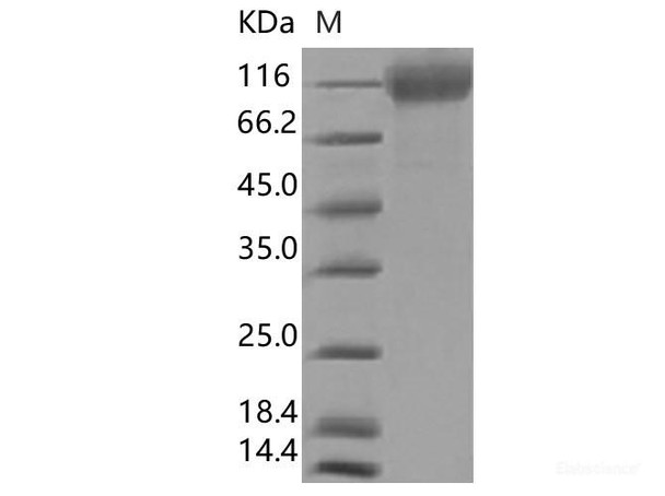 Recombinant SARS-CoV-2 Spike S1(ΔHV69-70,ΔY144,N501Y,A570D,D614G,P681H) (His Tag),Biotinylated