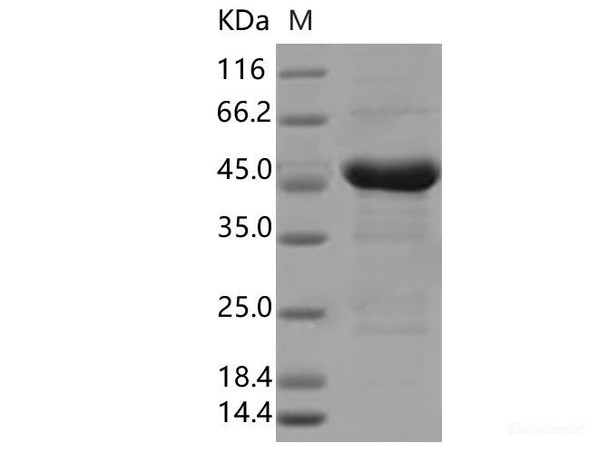 SARS-CoV-2 N Recombinant Protein (S194L) (His Tag)