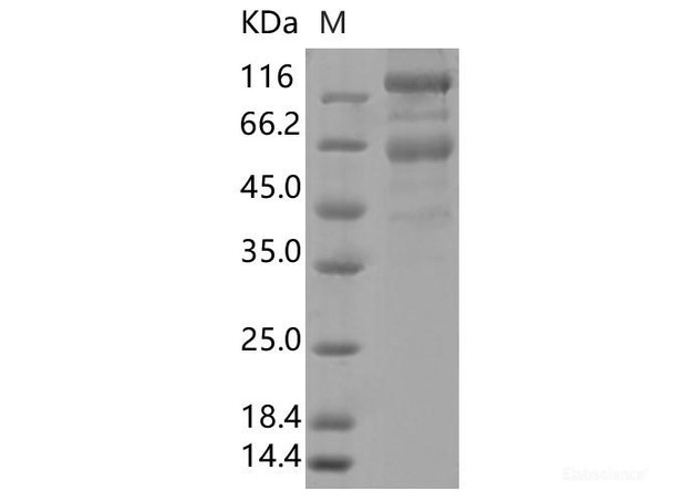 Recombinant SARS-CoV-2 Spike S1+S2 ECD (D80A, ΔLAL242-244, R246I, K417N, E484K, N501Y, D614G, A701V) (His Tag)