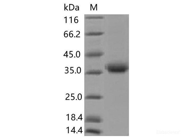 Recombinant SARS-CoV-2 Spike RBD (K417N) (His Tag), Biotinylated