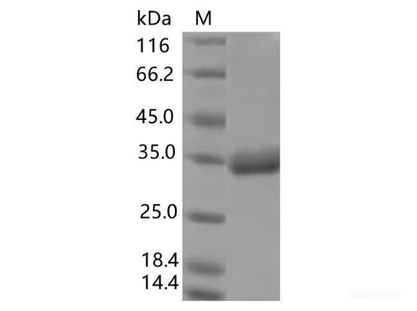 Recombinant SARS-CoV-2 Spike RBD (E484K) (His Tag), Biotinylated