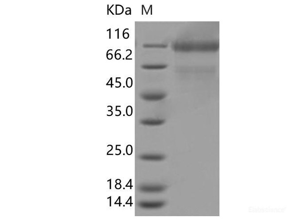 Recombinant SARS-CoV-2 Spike S1(T20N, D614G) (His Tag)