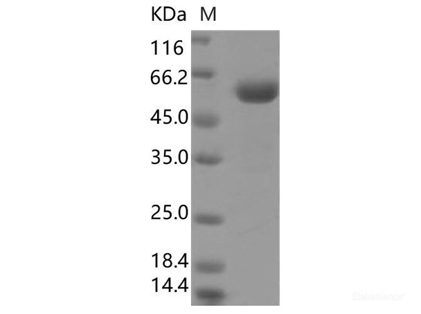 SARS-CoV-2 Spike Recombinant Protein (RBD, mFc Tag) (V367F)
