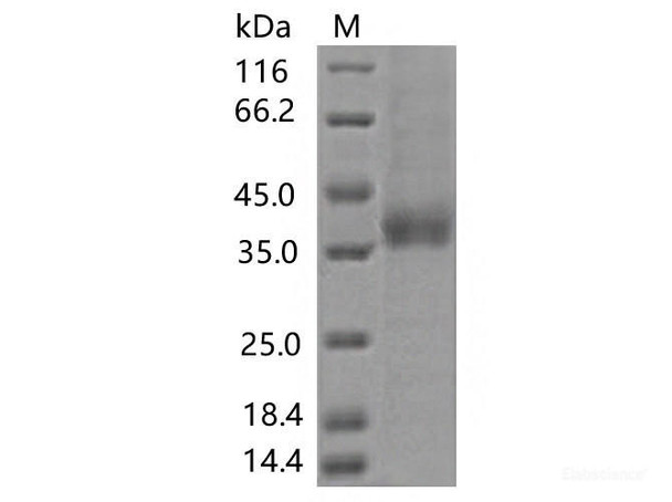 Recombinant SARS-CoV-2 Spike RBD (A372T) (His Tag)