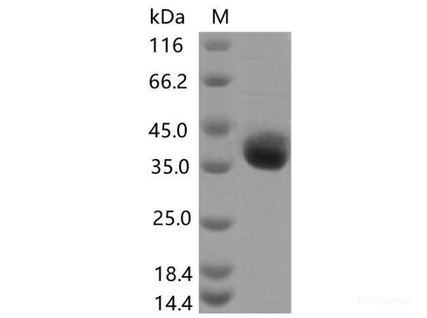 Recombinant SARS-CoV-2 Spike RBD (E406Q) (His Tag)